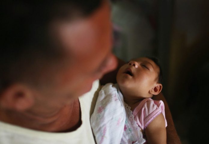 zika-crianca Boletim mais recente do Ministério da Saúde mostra que 1.551 bebês nasceram com microcefalia entre outubro do ano passado e o dia 4 de junho