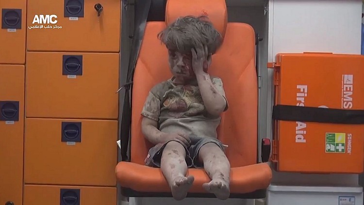 Foto de criança síria após ser resgatada de bombardeio