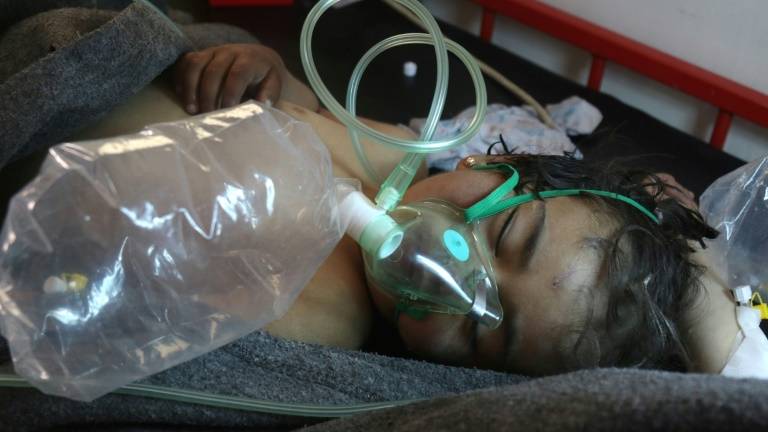 Criança é atendida após ataques FOTO: AFP