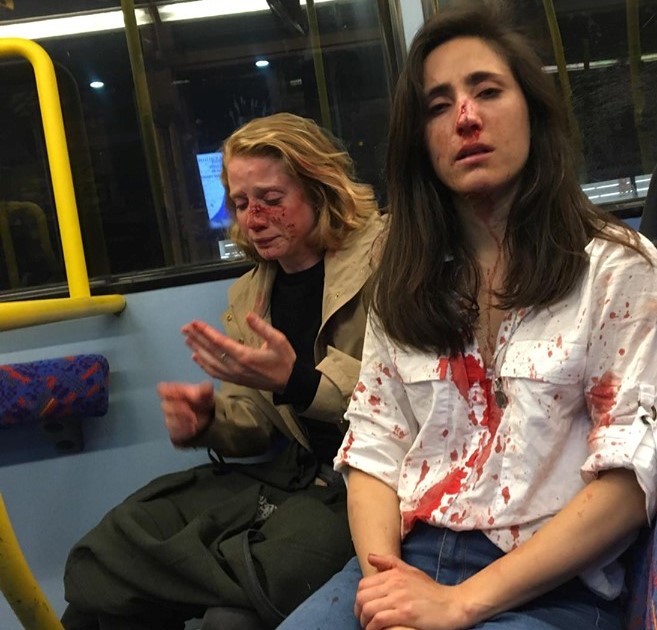 Casal de meninas foi atacado dentro de ônibus em Londres (Foto divulgação Facebook)