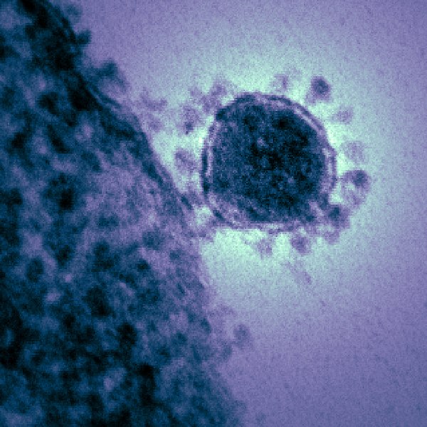 Coronavirus assusta o mundo Foto Wilimedia