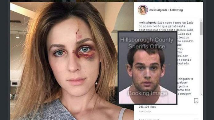 Melissa Gentz, usou as redes sociais para denunciar as agressões, em 2018 (foto: instagram Melissa Gentz) Melissa Gentz, usou as redes sociais para denunciar as agressões, em 2018 (foto: instagram Melissa Gentz)
