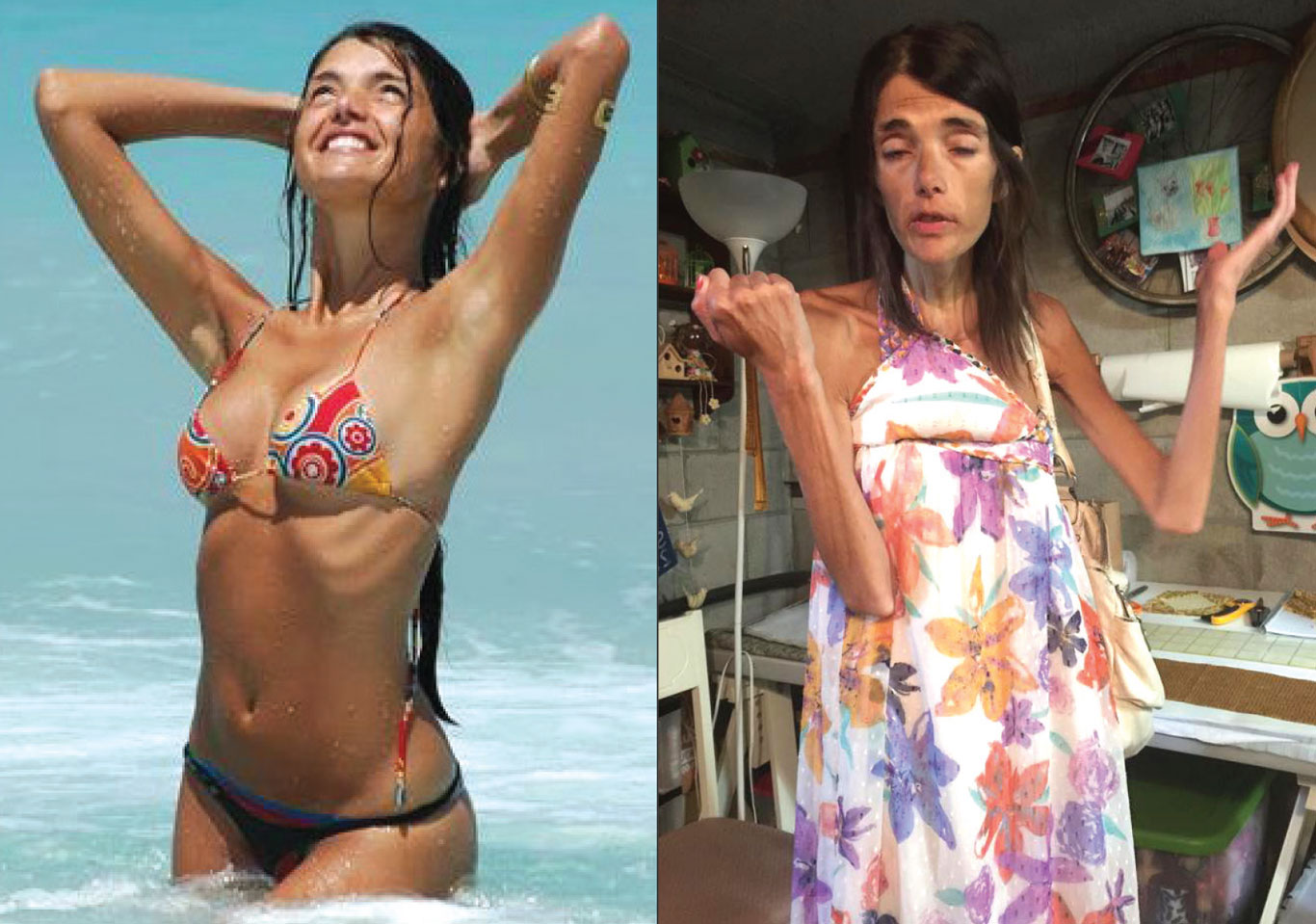 Simone sofre de anorexia nervosa e paranoia e se recusa a ser ajudada (Foto: Arquivo pessoal)