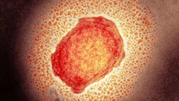 Enfermidade causada por um vírus tem atingido habitantes do continente africano há décadas (imagem: Science Library)