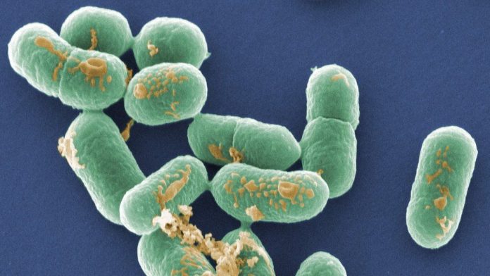 Contaminação pela bactéria listeria ocorre no consumo de alimentos infectados (foto: FDA)