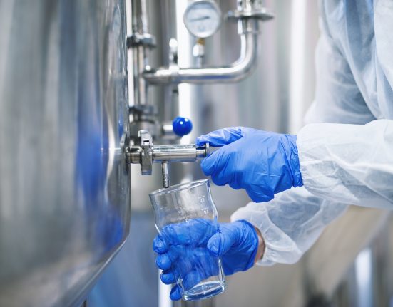 Testes diários são realizados para monitorar a qualidade e assegurar que a água fornecida à população permanece própria para consumo (Foto: Freepik)