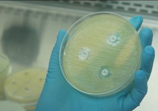 O alerta faz parte de uma investigação mais ampla sobre contaminação pela bactéria em alimentos prontos, que já causou internações e algumas mortes (Reprodução TV)