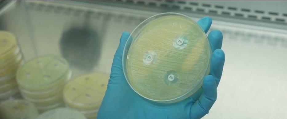O alerta faz parte de uma investigação mais ampla sobre contaminação pela bactéria em alimentos prontos, que já causou internações e algumas mortes (Reprodução TV)