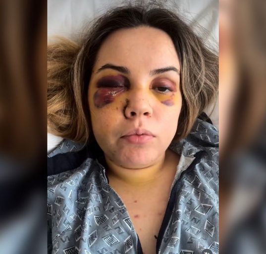 Após os episódios de agressão, Bárbara Ártico decidiu deixar o estado onde residia para recomeçar a vida ao lado do filho do casal (Foto: Reprodução redes sociais)