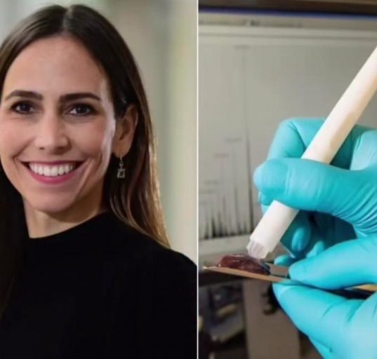 A expectativa é que a MasSpec Pen inaugure uma nova era na cirurgia oncológica, mais rápida, precisa e menos invasiva (Foto: Reprodução redes sociais)